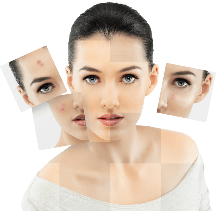 Antiaging